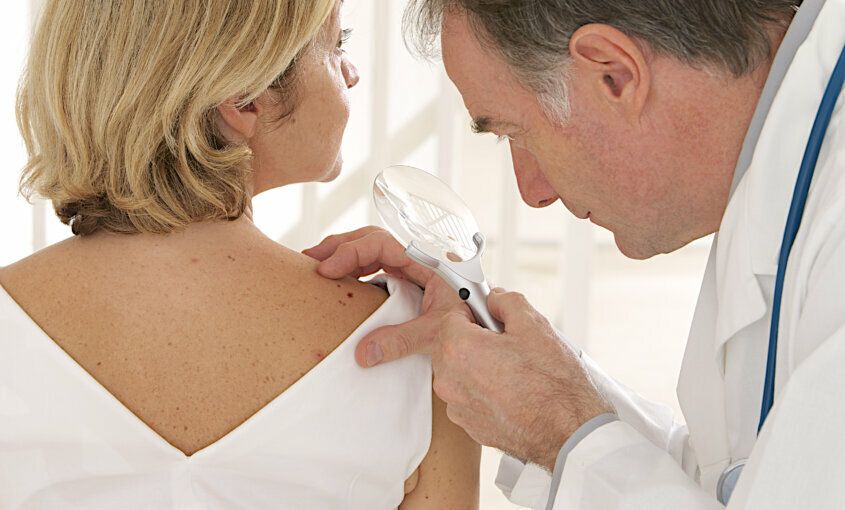 Prevención y tratamiento del cáncer de piel