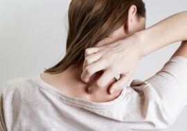 Psoriasis una enfermedad mas alla de la piel NOTA