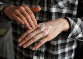 Vivir con Psoriasis NOTA