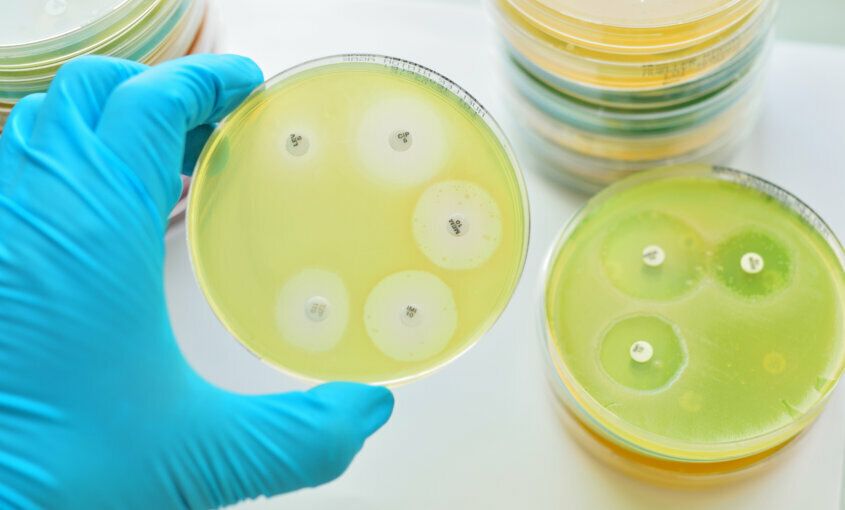 Resistencia antimicrobiana: ¿Cómo hacer un buen uso de los antibióticos?