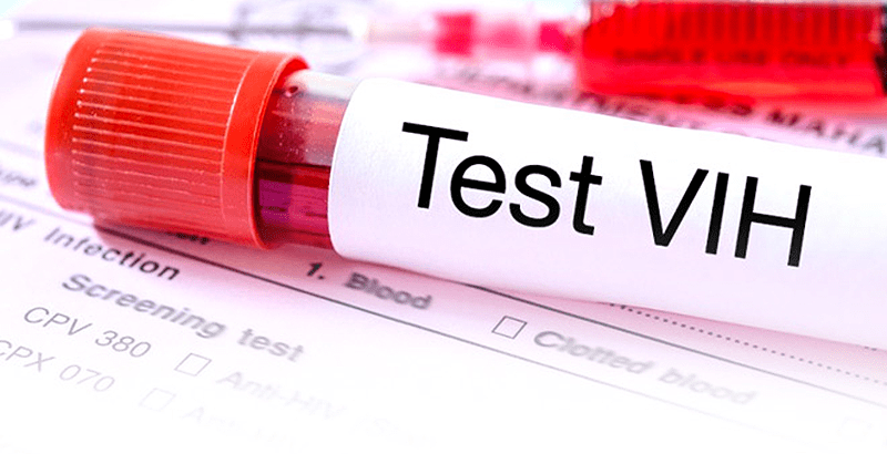VIH: qué hacer si el test da positivo
