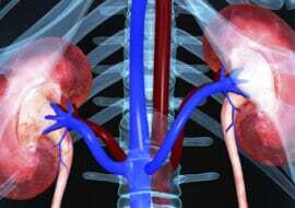 Insuficiencia renal ¿Qué es y como prevenirla?