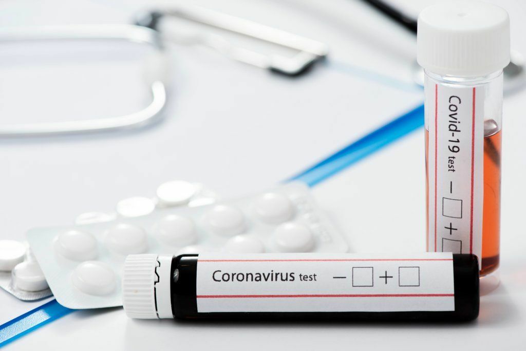 Test de COVID 19 herramientas esenciales para contener y controlar la pandemia NOTA