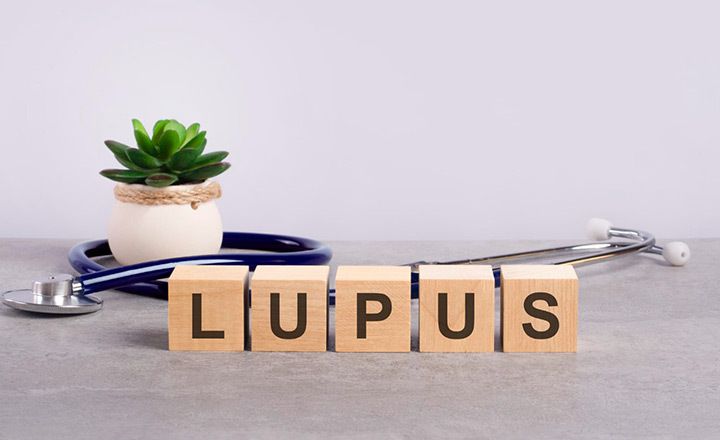 Día Mundial del Lupus: ¿Qué es y cuáles son sus síntomas?