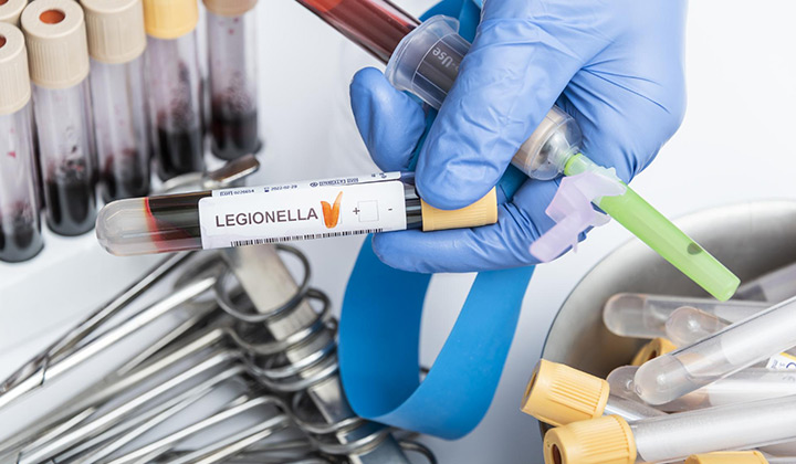 Legionella: qué es esta bacteria que puede causar una neumonía fatal